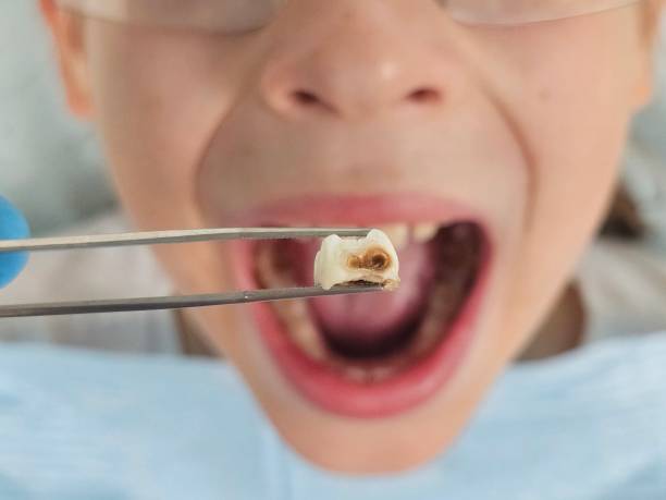 Best Tooth Infection Emergency Dentist  in Westwood, PA